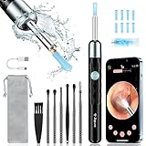 ZUPORA Ear Wax Removal, Ear Camera with 1440P HD, Ear Cleaner with Camera Built-in WiFi, Earwax Removal Kit with 6 Ear Pick, Otoscope with Lights, Ear Cleaning Kit for Android and iOS (Black)
