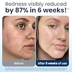 Clean Skin Club Clean Towels XL®, 100% USDA Biobased Face Towel, Disposable Face Towelette, Eczema Association Accepted, Makeup Remover Dry Wipes, Ultra Soft, 1 Pack, 50 Ct - Image 3