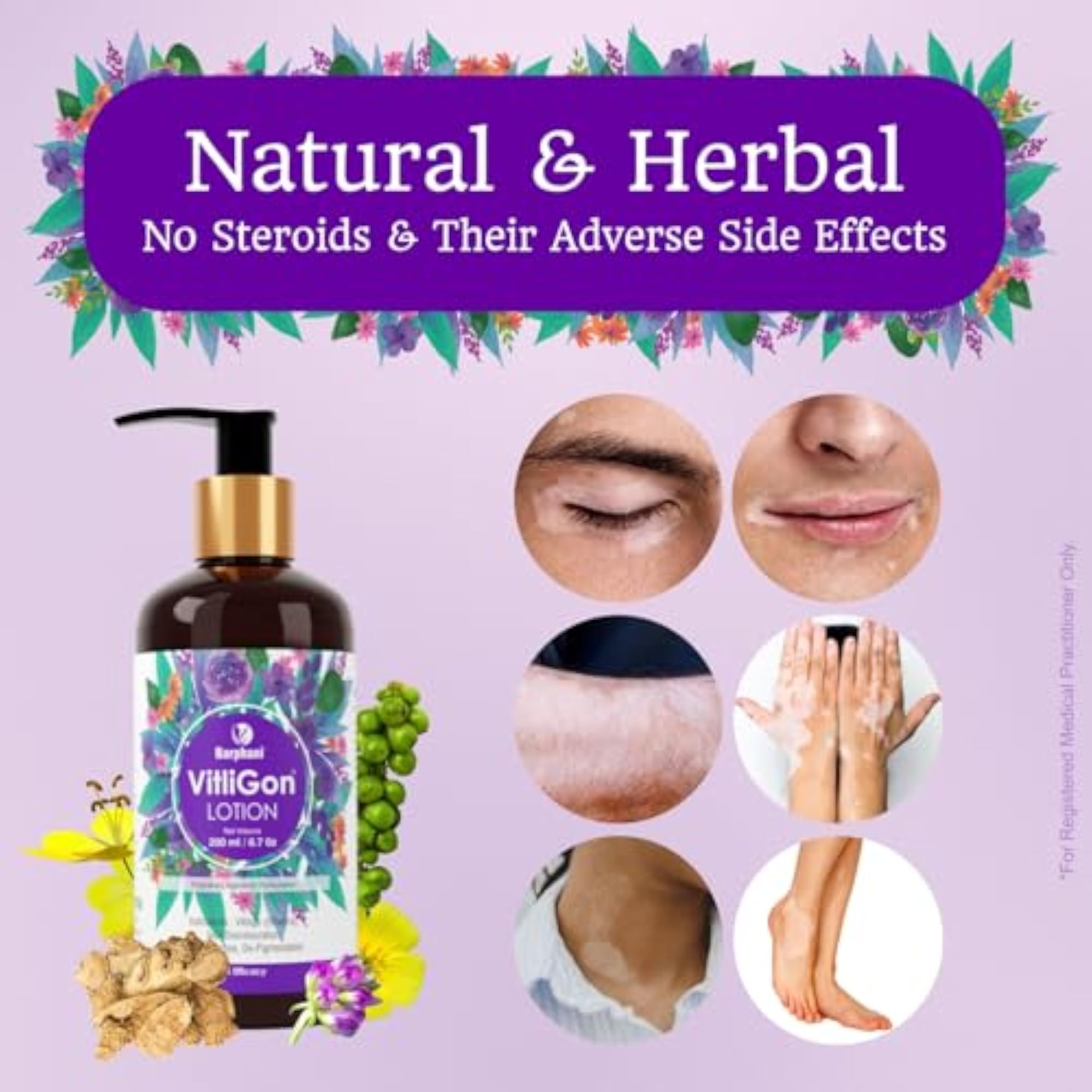 VitliGon Lotion for Vitiligo & Uneven Skin Tone