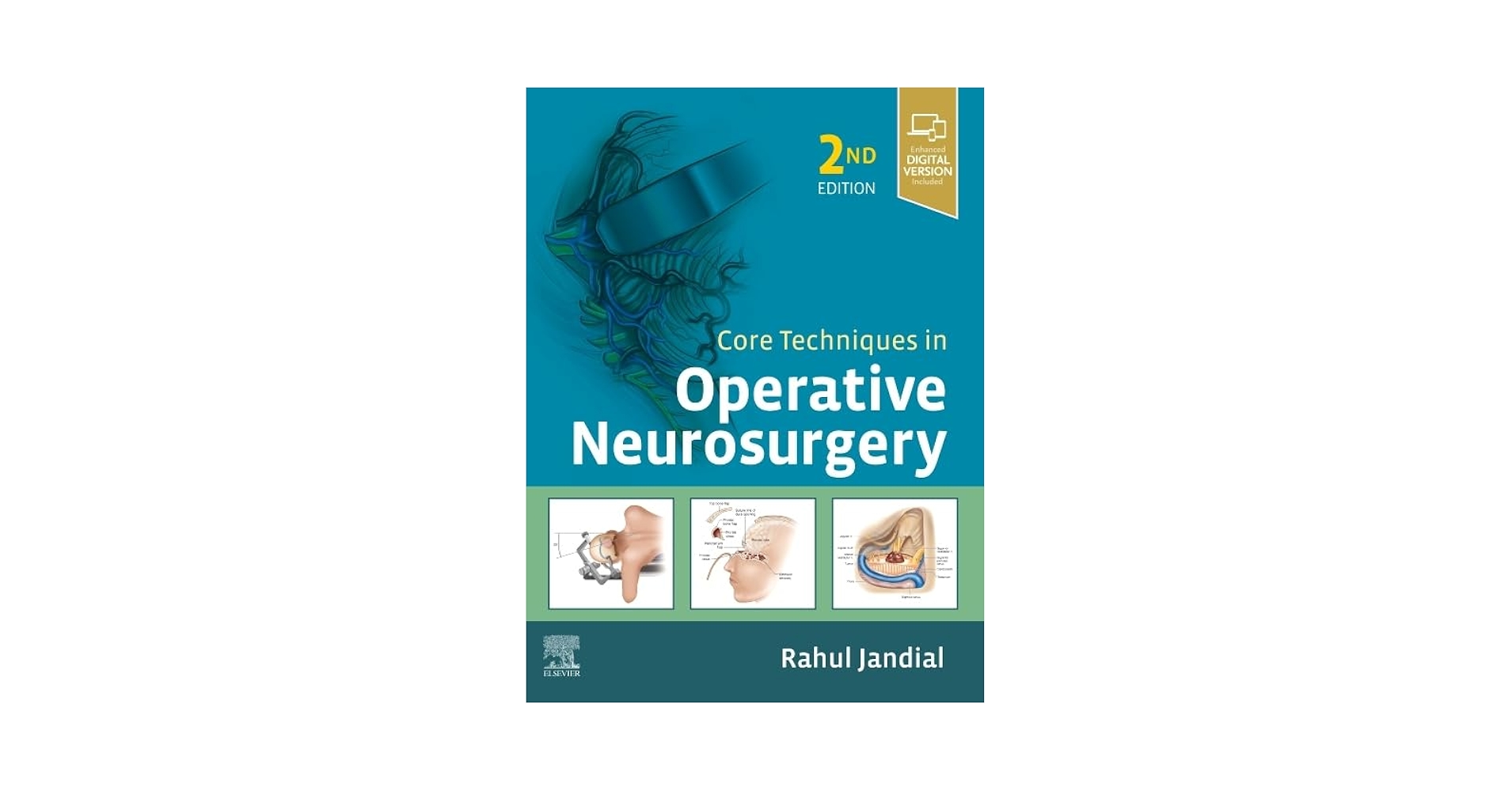 Core Techniques in Operative Neurosurgery: Expert Consult