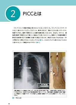 PICC 末梢挿入式中心静脈カテーテル管理の理論と実際 | 井上
