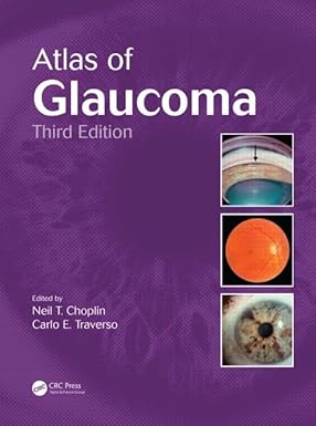 Atlas Of Glaucoma 3Ed (Hb 2014)