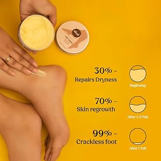 Vilvah Store Foot Cream for dry and cracked feet moisturizes men and women rough heels, and softens the chapped or calloused feet suitable for all skin types, 100ml