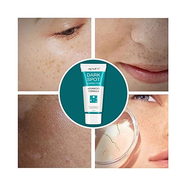 Dark-spot-remover-suitable-for-body-and-face-dark-spot-correcting-cream-containing-niacinamide-effectively-diminish-the-black-deposits-of-the-skin-improve-the-complexion-suitable-for-all-skins Dark spot remover, suitable for body and face, dark spot correcting cream containing niacinamide, effectively diminish the black deposits of the skin, improve the complexion, suitable for all skins