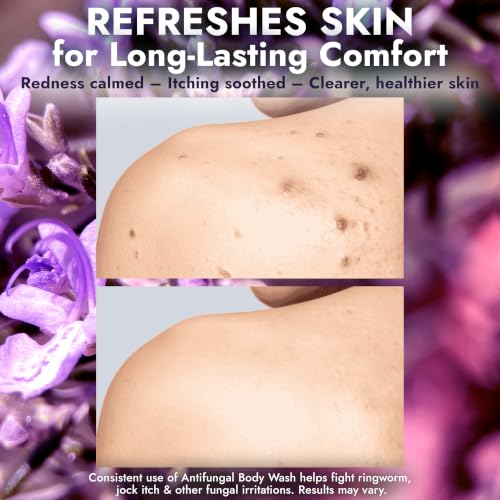 Image of Antifungal Body Wash with Lavender Essential Oil 1% Tolnaftate Jock Itch