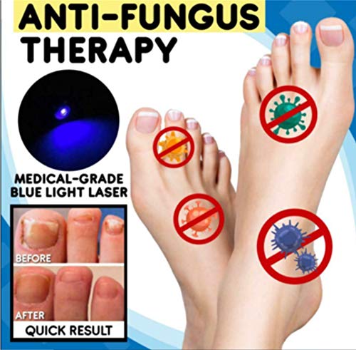 Antischimmelbehandelingsset voor thuis, teennagelbehandelingspen voor snel effect voor nagelschimmel, zoals onychomycose… - Image 3