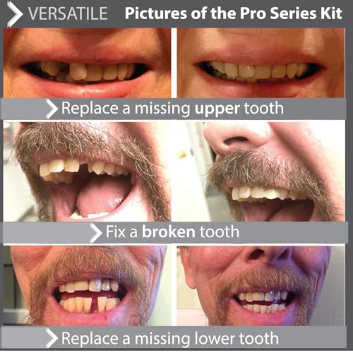 Image of Instant Smile Flex Teeth (Natural Shade) and Pro Series Tooth Kit - 2 great Instant Smile Products