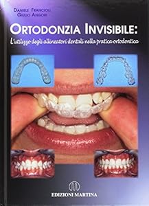 Ortodonzia invisibile. L'utilizzo degli allineatori dentali nella pratica ortodontica