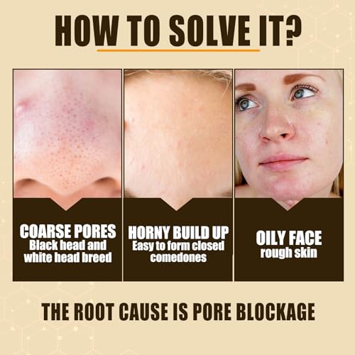 Grospe Lactobionic Acid Pore Refining Serum,Minimize Pores Serum Gentle Formula Clean Pore Shrink Pore Firming Skin Reduce Fine Lines Facial Liquid for All Skin 30 ml