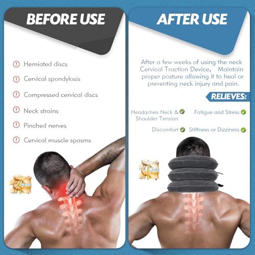 Image of Jaximy Neck Stretcher, Cervical Traction Device, Neck Traction Device, Neck Pain Relief, Adjustable Inflatable Neck Brace & Neck Stretcher, Neck Decompression Home Use (Dark Gray)