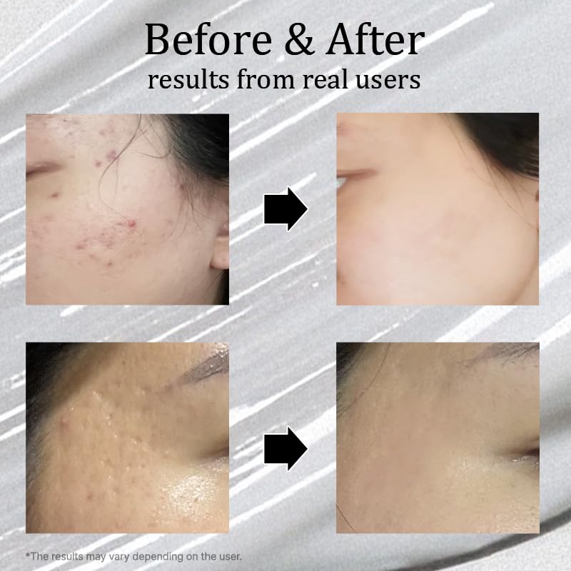 Miraclemuse AHABHA Medi Cream 35ml ahamedi 7.5% Cream, Anti-aging Eye & Neck Cream with Treatment to Firm Skin, Reduce Wrinkles, Fine Lines, Signs of Aging, Gentle Daily Korean Skin Care - Image 3