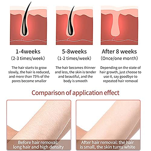 Miniatura 4 de Iborria IPL - Depilación láser permanente sin dolor para mujeres y hombres, actualización a 999,999 destellos para piernas faciales, brazos, axilas,