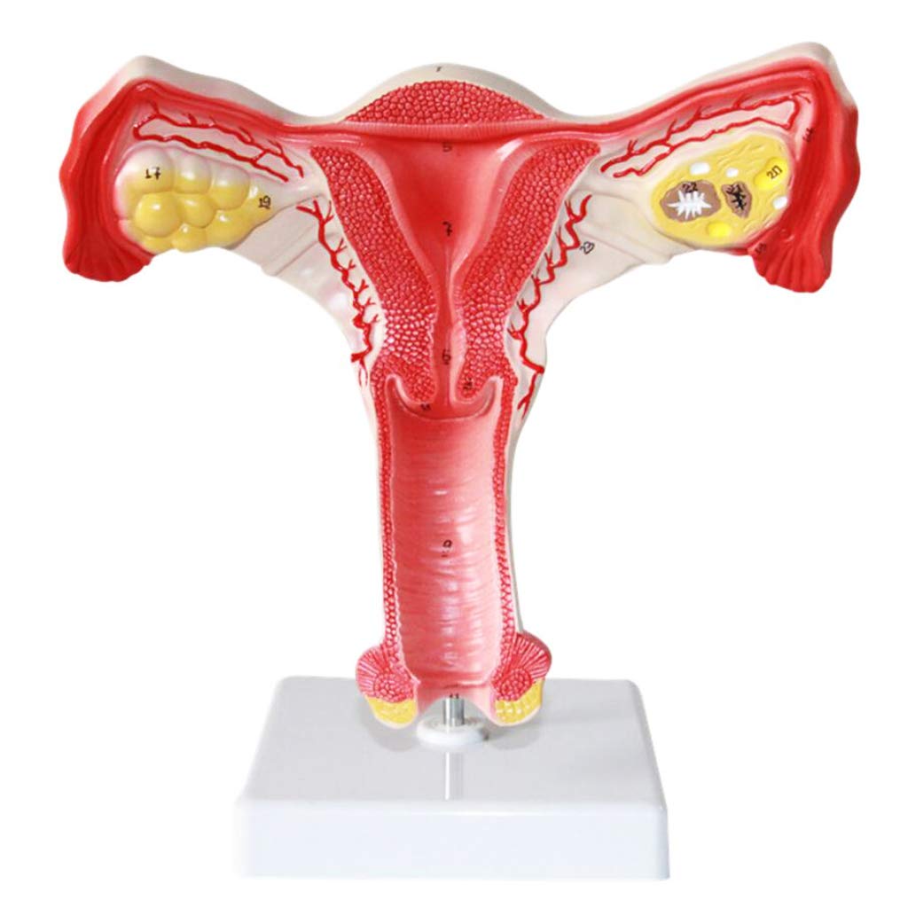 Sjdopulse Women's Uterine Lesion Model - Human Organ Anatomy Model - Internal And External Organs Model - Medical Anatomical Uterine Model Human Anatomy Science Models