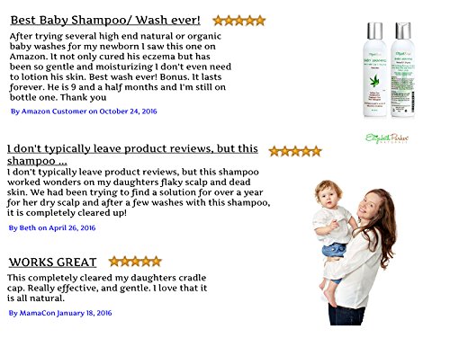 cradle cap itchy scalp relief