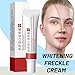 2 Pcs Whitening Freckle Cream, Acne Scar Removal Treatment Cream, Pigmentation Removal Cream for Face, Moisturizing Removes Facial Melasma Dark Spots Wrinkles Blemishes (whitening freckle cream)