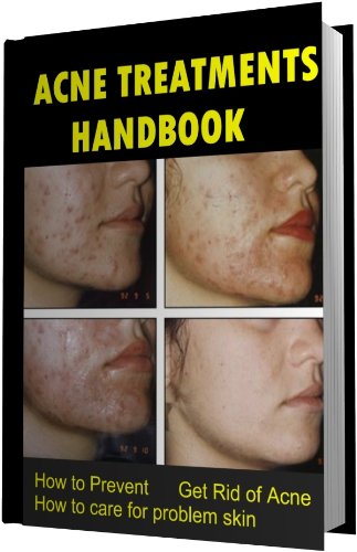 Your Acne Treatments Handbook - How to Prevent, Get Rid of Acne. How to ...