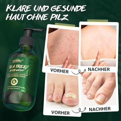 ‎Teebaum-Duschgel, Lindert Hautpilz, juckende Haut, Leistenflechte, Fußpilz, Ekzeme und Körpergeruch, Teebaum Körperwäsche mit Pfefferminzöl und Kokosöl, Duschgel mit Pumpe für Männer Frauen, 300 ml