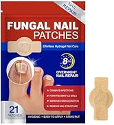 21Pcs Fungal Nail Patches, Toenail Fungus Treatment Extra Strength, Nighttime Nail Repair Patches...