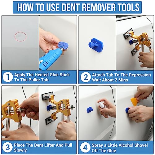 Zeusfire Dent Puller,Dent Removal Kit For Cars… #TOP5