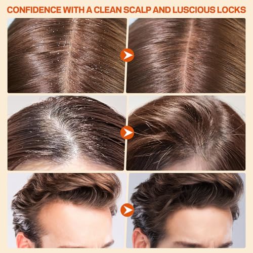 Scalp Scrub, Pumpkin Seed Oil Scalp Exfoliator With Biotin & Rosemary, Sulfate Free Scalp Detox for Itchy Scalp & Dandruff & Buildup Removal & Hair Growth, Hair Scrub with Scrubber - Image 4