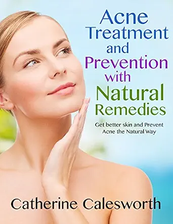 Acne Treatment and Prevention with natural remedies: Get Better Skin and Prevent Acne the Natural Way-Wow! eBook