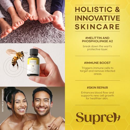 fast-acting bee venom wart remover wart freeze off with salicylic acid amp bee venom cream - wart removal for plantar genital 18 ml