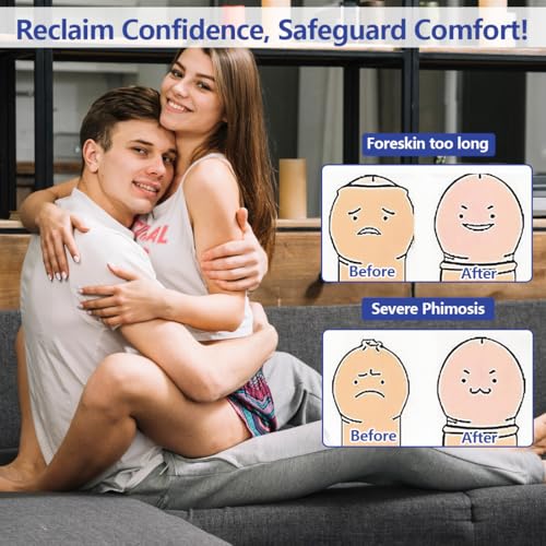 Phimose Salbe Männer,Natürliche Kortisonsalbe,Phimose-Creme Für Vorhautverengung,Phimose-Vorhaut-Korrektur-Gel Für Überschüssige Vorhaut, Schnelle Und Sanfte Wirkung,hydratisiert und gesund,2 Stück