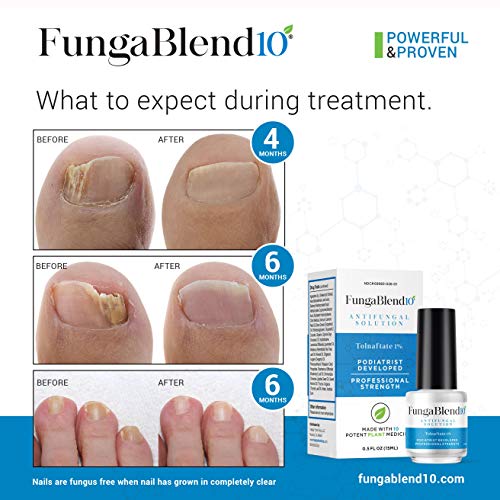 FungaBlend 10 Antifungal Medication1 Tolnaftate and 10 Plant