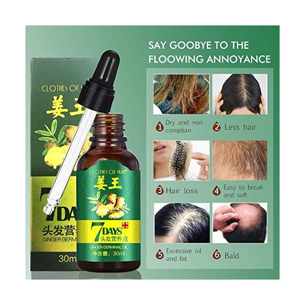 Ginger-Germinal-Oil-Ginger-Hair-Growth-Serum-Ginger-Essential-Oil-Stop-Hair-Loss-Hair-Thinning-Treatment-Hair-Growth-Oil-for-Women-Men-30ML-3-Pack Ginger Germinal Oil, Ginger Hair Growth Serum, Ginger Essential Oil Stop Hair Loss Hair, Thinning Treatment Hair Growth…