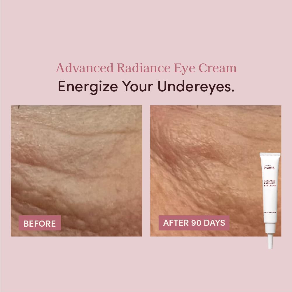 Pretti5 Eye Cream: Dark Circles & Wrinkles -3 Pretti5 Eye Cream: Dark Circles & Wrinkles -3