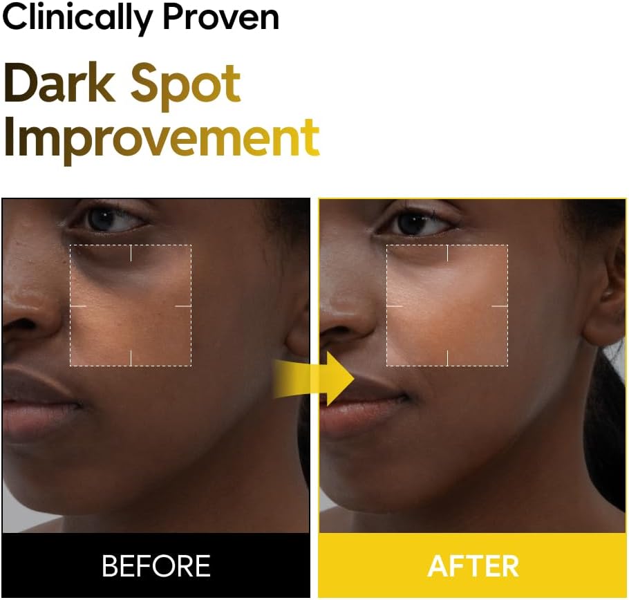 5% Niacinamide Milky Toner with Kojic Acid & Turmeric – Dark Spot Care, Skin Tone Improvement, Gentle Hydration for Face & Body, 200ml (6.76 fl oz) - Image 3