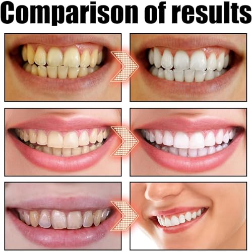 Zahnfleischpflege Mundspülung,237ml Mundwasser für Reisen - Lang Anhaltende Mundpflege Für Aufhellung Der Zähne Kinder Erwachsene Zahnspangen – Bild 6