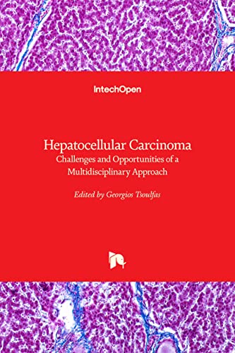 Hepatocellular Carcinoma: Challenges and Opportunities of a Multidisciplinary Approach