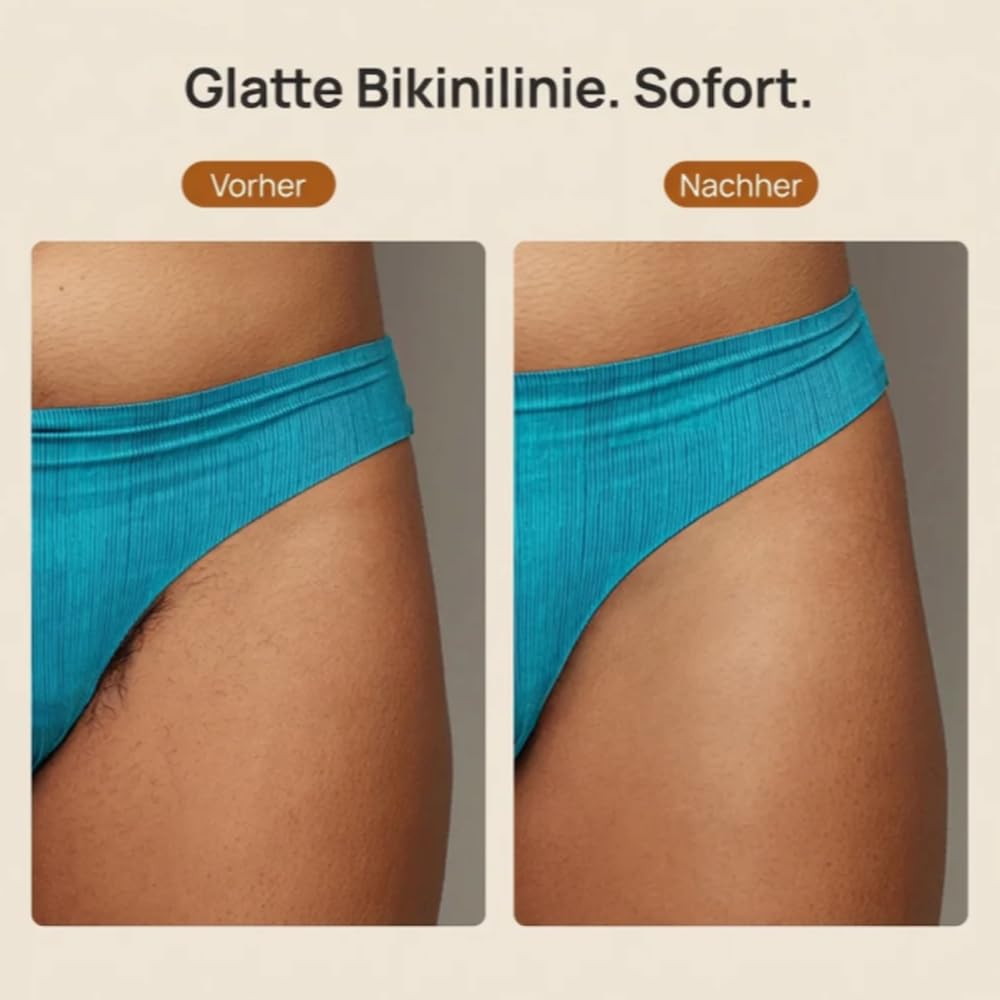Aluvea Smooth Trim - 2-In-1 Haartrimmer Für Damen | Sanfte & Glatte Rasur Für Bikinizone, Achseln & Gesicht | Gegen Rasurbrand & Eingewachsene Haare (Weiß)