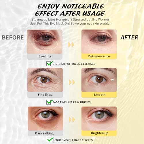 Augenpads(24 Paar), Koffein Augenmasken gegen Augenringe, geschwollene Augen und Tränensäcke, Kollagen Augenpads gegen Falten und Schwellungen, Hautpflege Geschenk für Sie,Under Eye Gel Patches