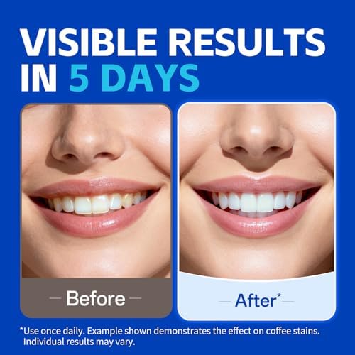 PERSMAX Teeth Whitening Strips, 18 Strips 9 Treatment (7 + 2 Bonus) - 1