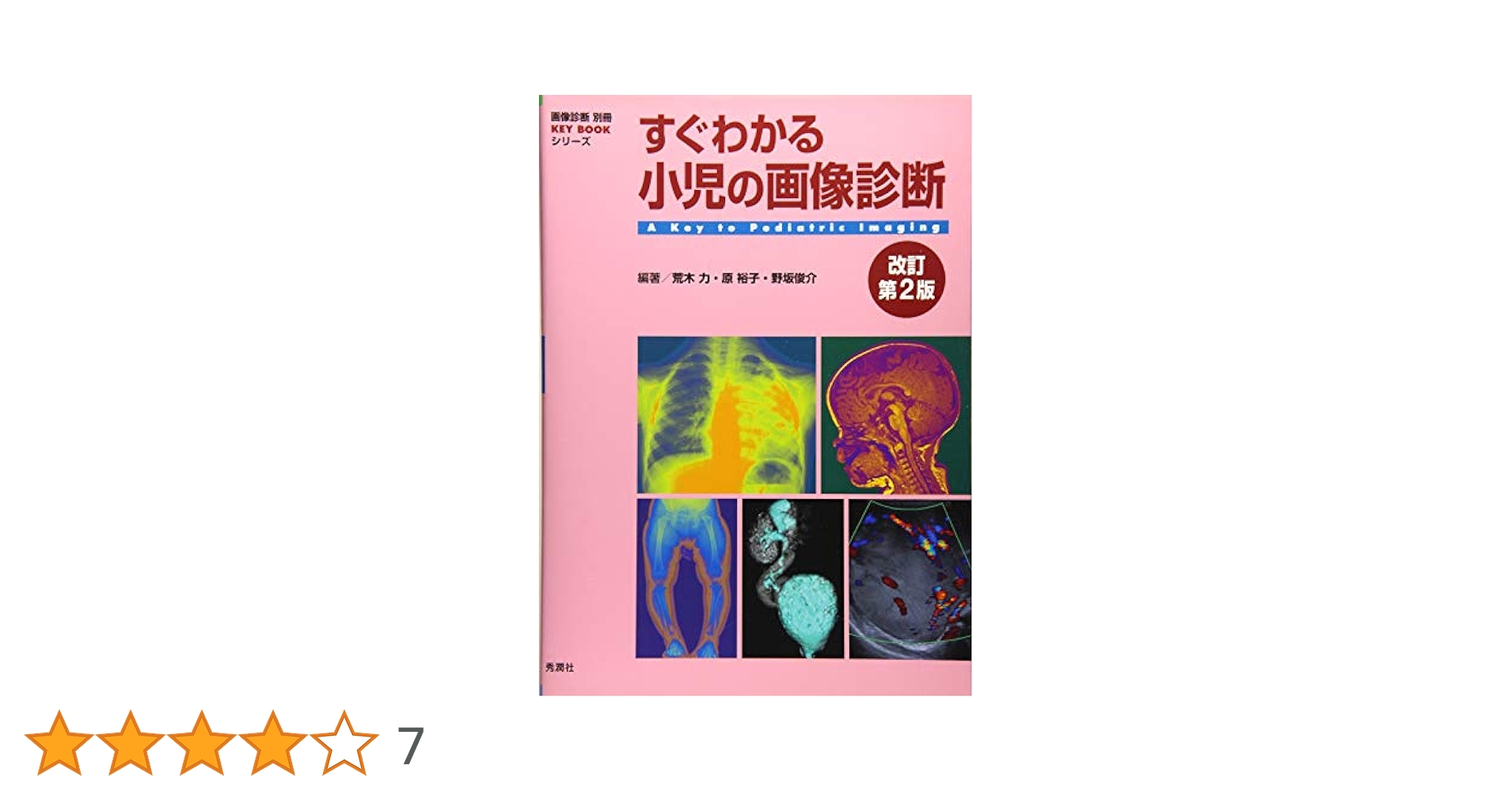 すぐわかる小児の画像診断 改訂第2版 (画像診断別冊KEYBOOK