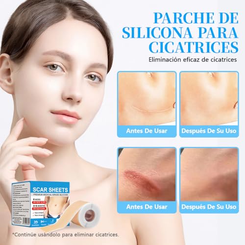 Miniatura 3 de Silicone Scar Sheets,Silicone Scar Tape,Láminas De Silicona De Grado Médico Para,Cesáreas,Quemaduras Y Acné 4cm 150cm ,Transpirables Para Todo Tipo De Piel,Parches Cicatrizantes,Reutilizables