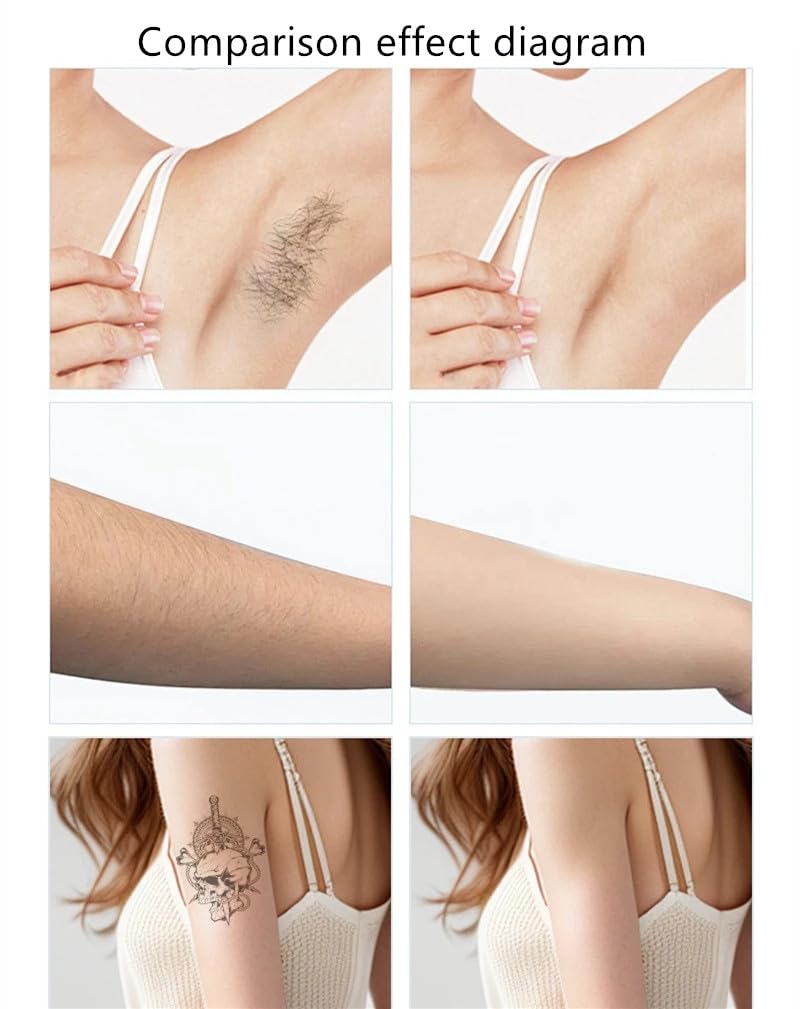Dispositivo di epilazione laser a diodo 2 in 1 a picosecondi, macchina professionale per epilazione permanente indolore con manico di ghiaccio, dispositivo di bellezza per la rimozione dei tatuaggi