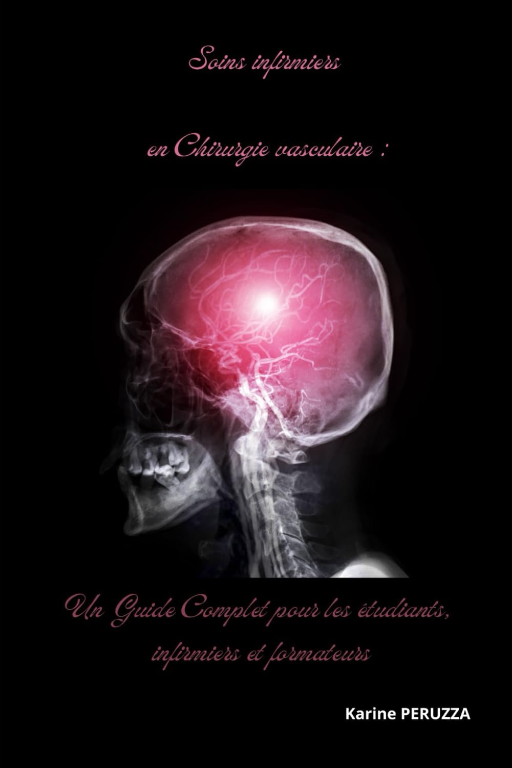 Soins infirmiers en Chirurgie vasculaire : Un Guide Complet pour les étudiants, infirmiers et formateurs (Soins Infirmiers en service de Chirurgie avec Karine Peruzza)