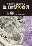 腎生検からここまで解る臨床病態50症例
