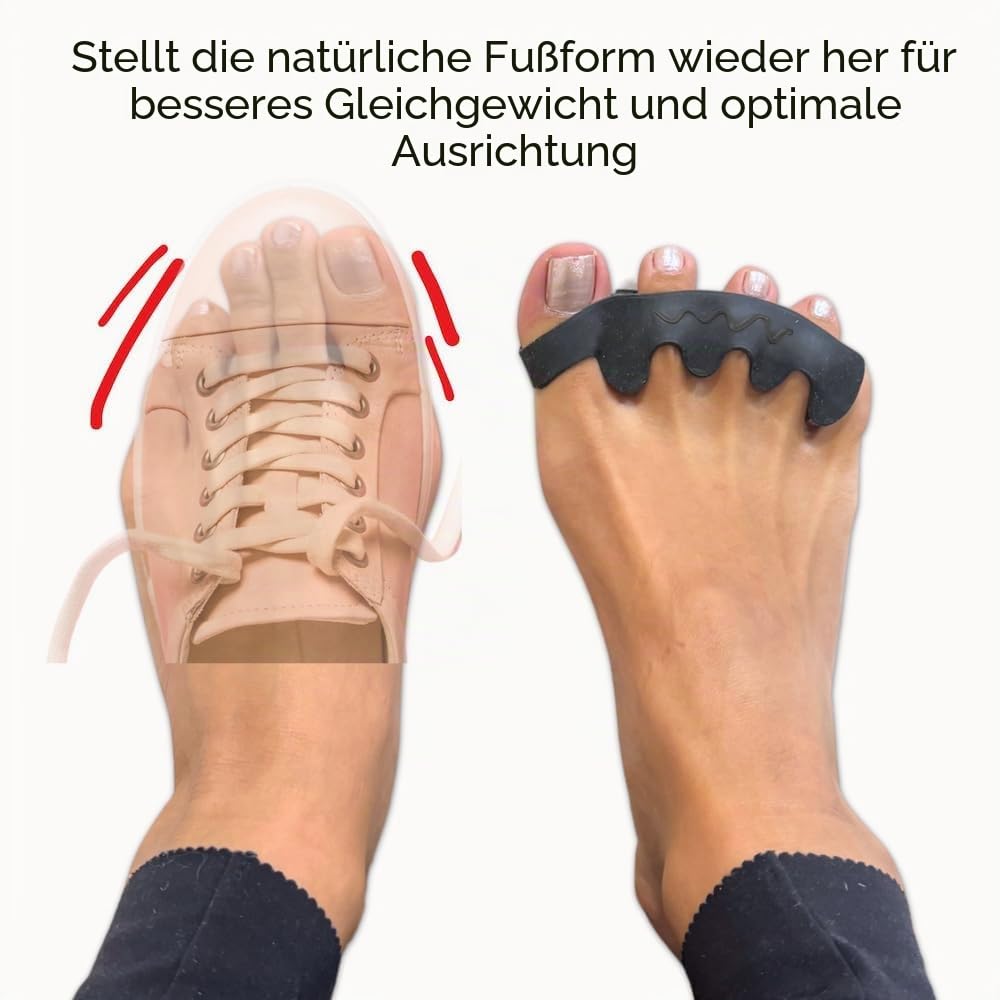 Der Zehenspreizer von Spacer Mobility, Erholung von Grund auf, korrigiert Ballenzehen, Plantarfasziitis und korrigiert Zehen, Unisex-Therapeutischer Zehenspreizer, lindert Fußschmerzen und