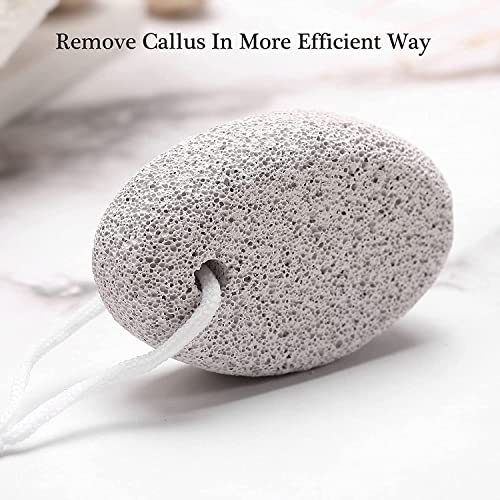 Image of Red Square Pumice Stone 2 Pcs, Natural Lave Pumice Stone for Feet /Hand, Small Callus Remover /Foot Scrubber Stone for Men /Women - Multicolor