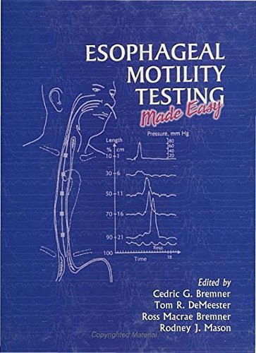 Buy Esophageal Mobility Testing Made Easy — BookShops.in