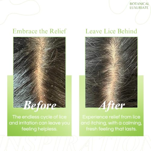 Image of Tea Tree Natural Anti Lice and Nits Shampoo 300 ml with Transparent Lice Removal Comb With Tea Tree and Neem Extracts(Pack of 3)