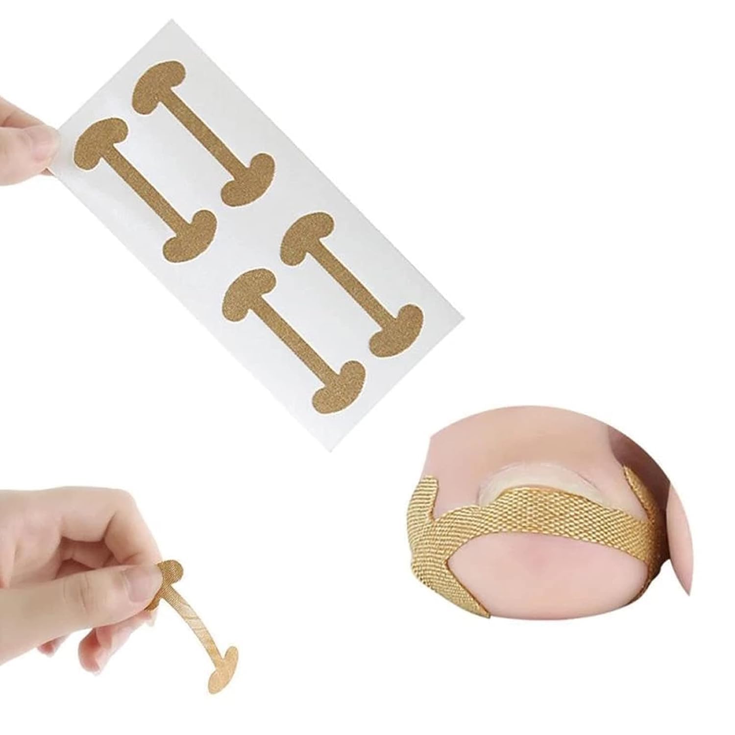 WORLD GLOBAL 5 PCS Ingrown Toenail Corrector Stickers Breathable Self-Adhesive Elastic Toenail Correction Patch for Toenail Treatment Fingernail Care Protect Toe Nail-image-47