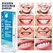 Teeth Whitening Pen - Removes Years of Stains Caused by Coffee, Wine, Smoking, Travel-Friendly - 3 Pens