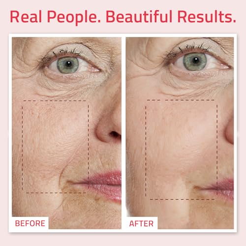 YEOUTH Retinol Serum for Face with Hyaluronic Acid & Vitamin E, Hydrating Anti-Aging Facial Serum, Smoothing Night Skincare for Face 1oz image 4