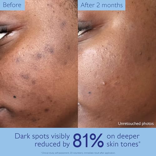 Image of Caudalie Vinoperfect Brightening Dark Spot Serum Vitamin C Alternative