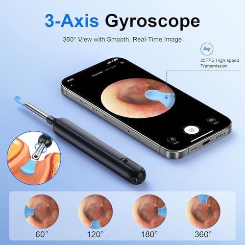 Image of Oxbird(200-300W-PX) HD Wireless Otoscope with Light Ear Wax Camera, Ear Wax Remover Removal Cleaner Cleaning Kit, Suitable for Apple /Android, Dad and Madam Artifact,Perpetual Commitment